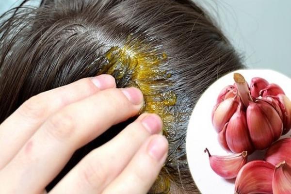 درمان های طبیعی موهای نازک