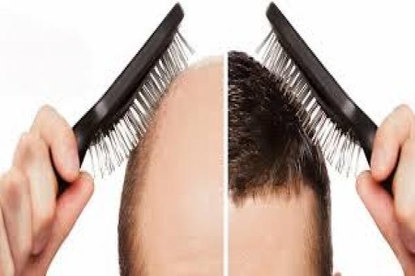 تقویت ورشد مو با این روش های موثر